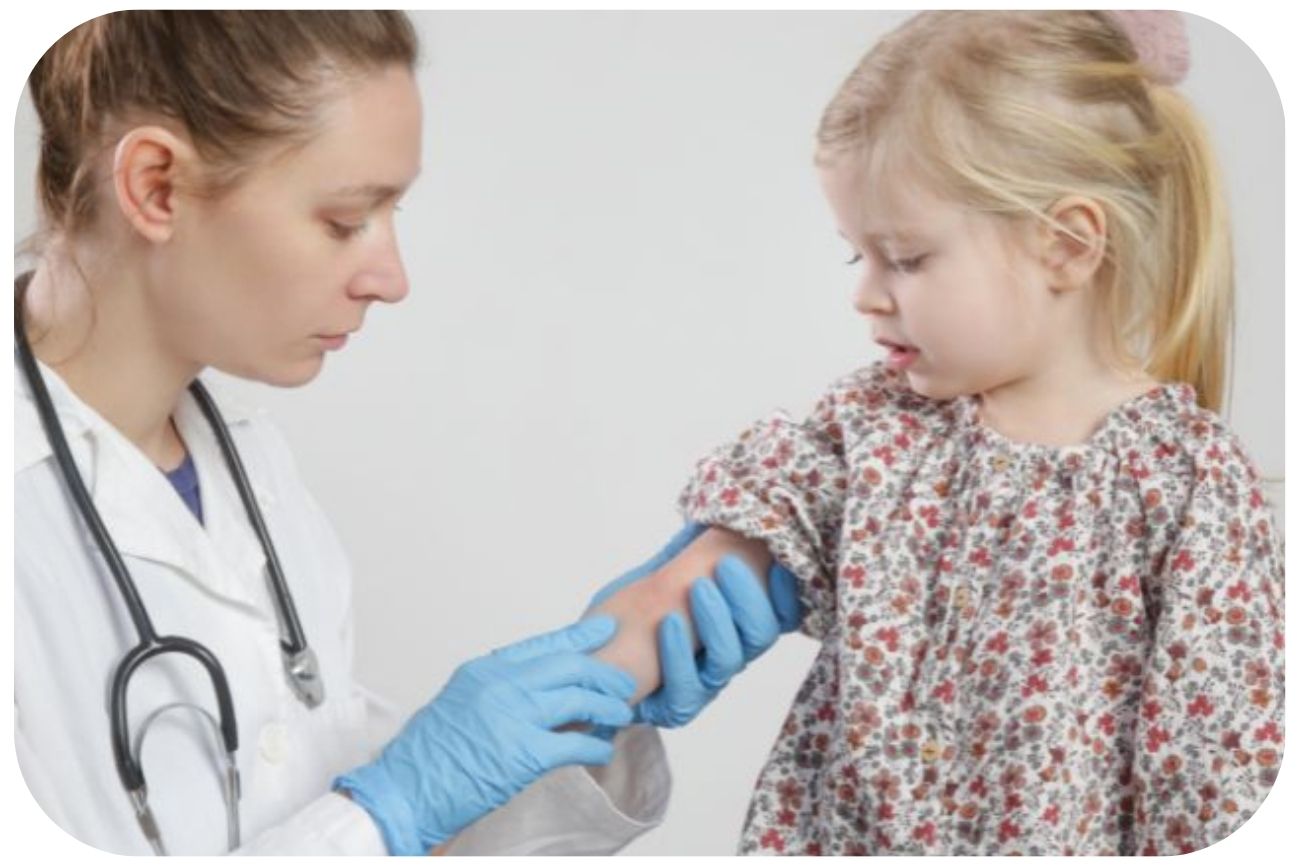 Ärztin diagnostiziert Neurodermitis bei einem Mädchen durch Hautuntersuchung