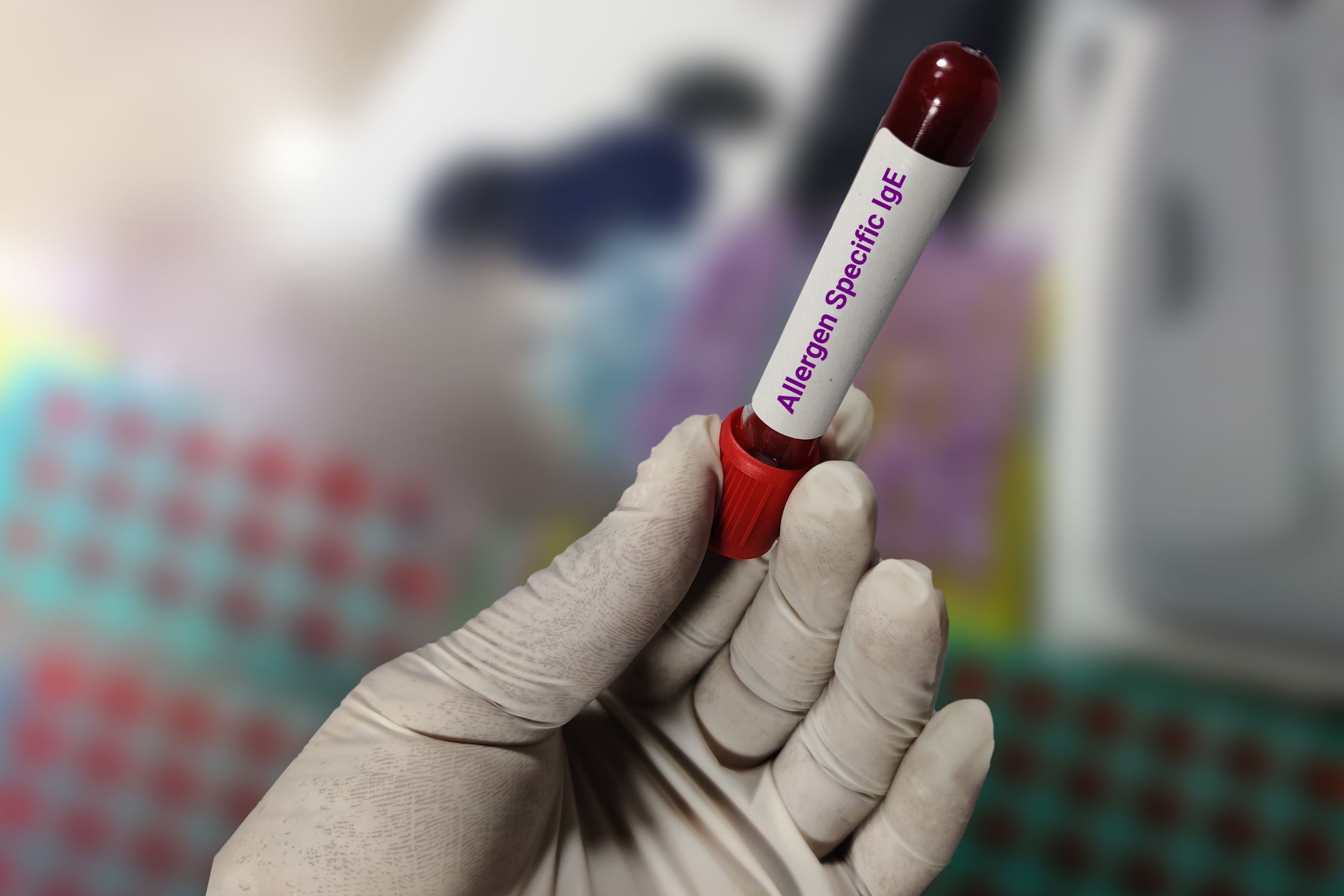 Blutprobe Spezifischer IgE-Test