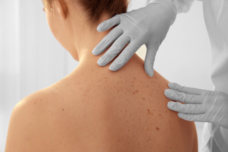 Dermatologe Studienbelegt Dermatologe betrachtet Haut s