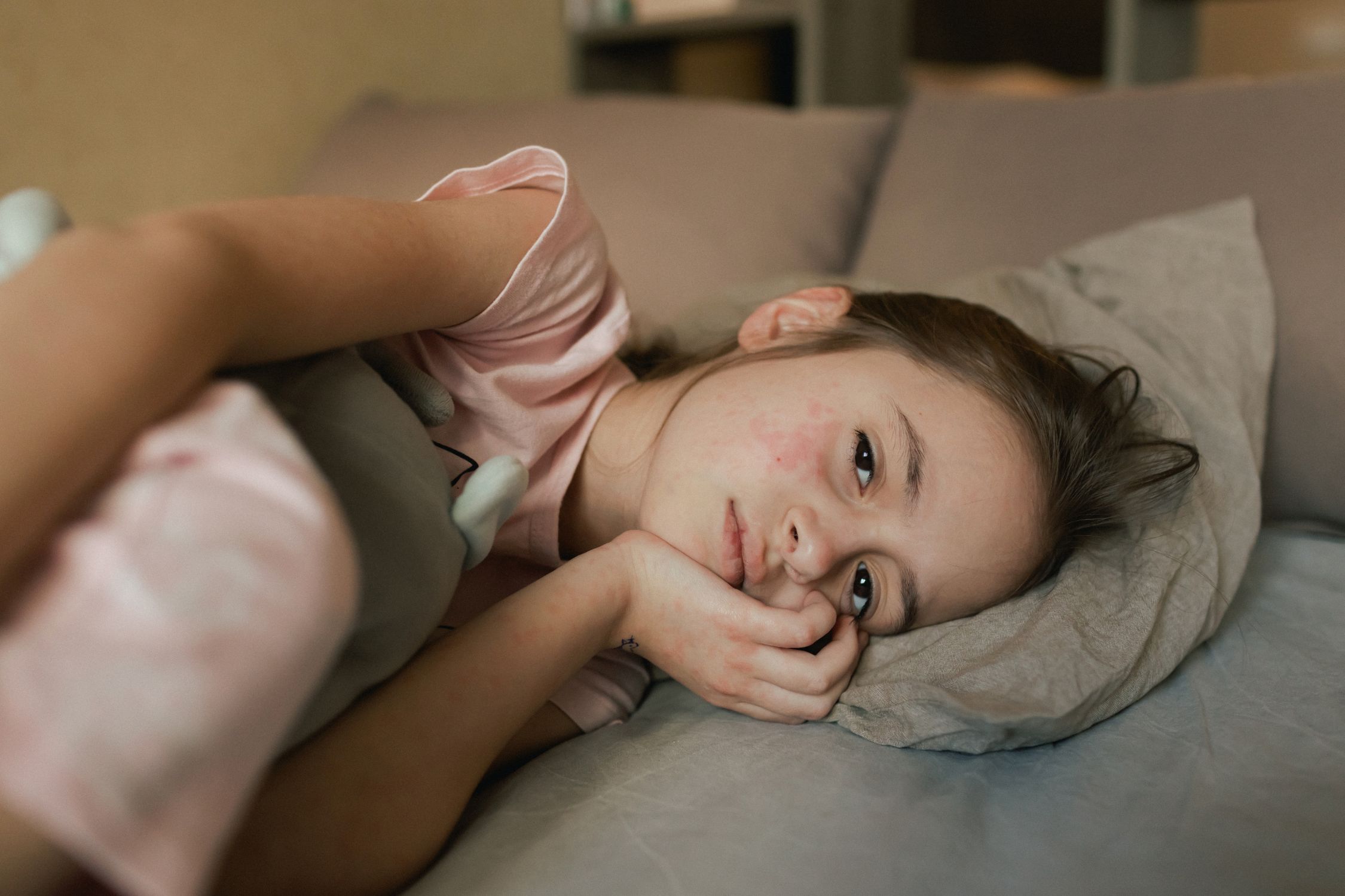 Jugendliche mit Neurodermitis schlaflos im Bett