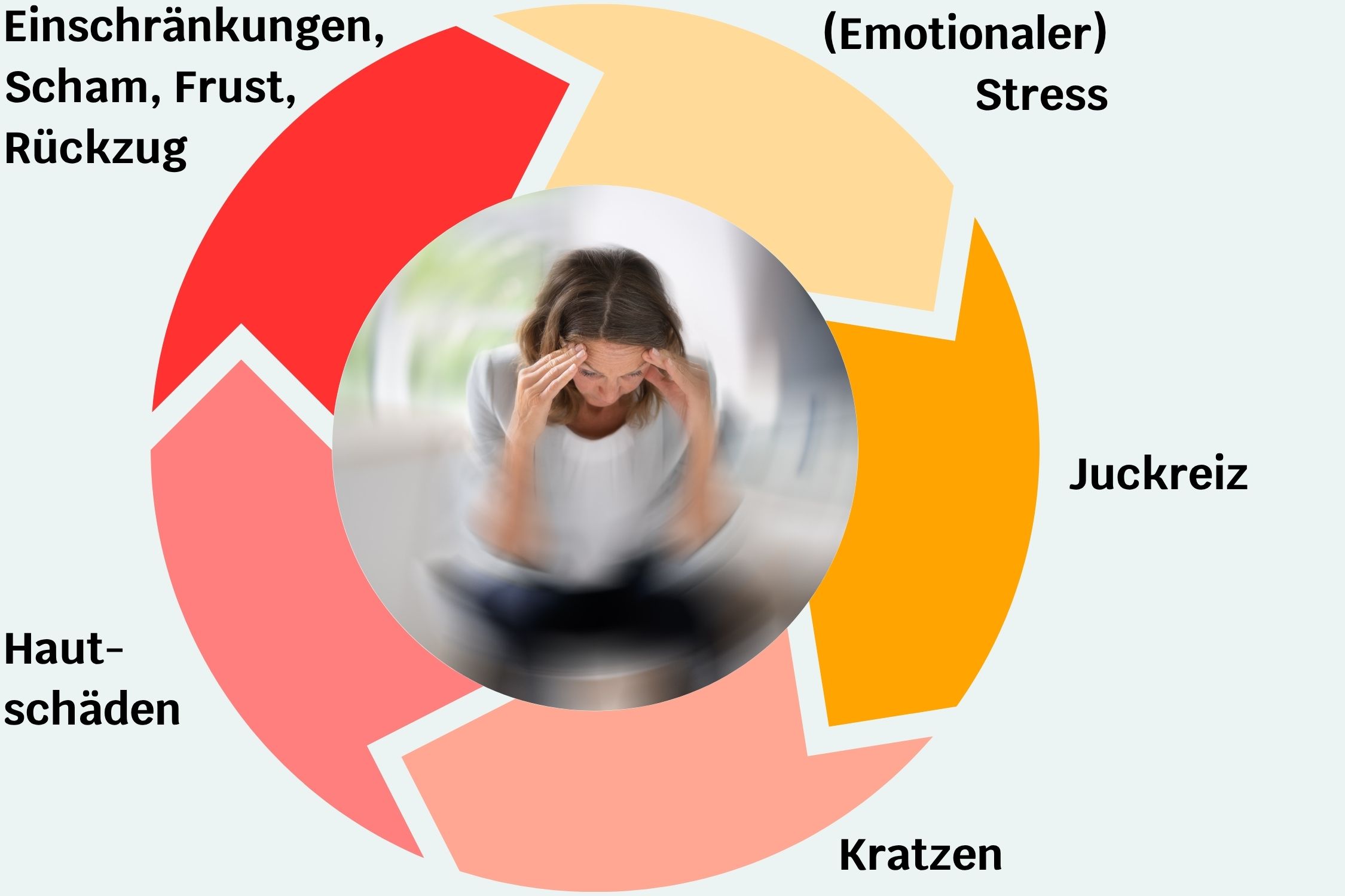 Das Bild zeigt den Kreislauf aus emotionalem Stress, Juckreiz, Hautschäden, Frustration und neuem Stress
