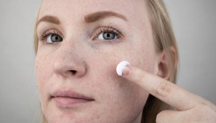 Frau mit sehr trockener Haut cremt sich das Gesicht ein