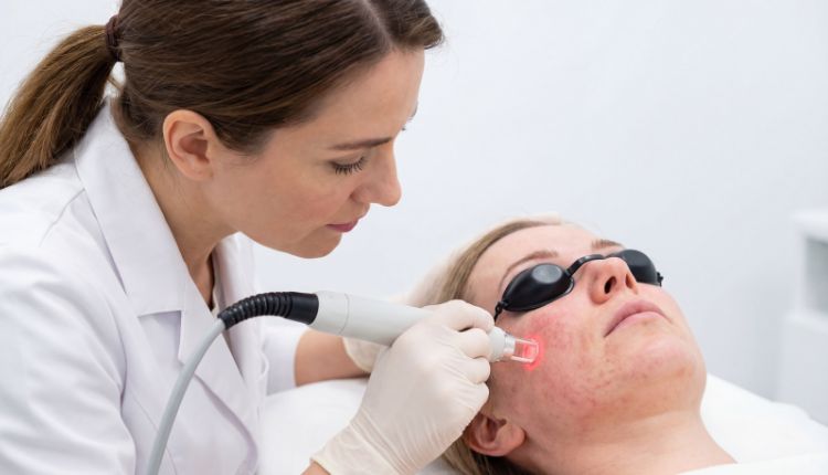 Dermatologin führt Laserbehandlung bei Frau mit Rosacea durch