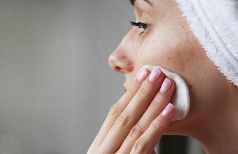 Frau mit Akne reinigt sanft Gesicht mit Wattepad