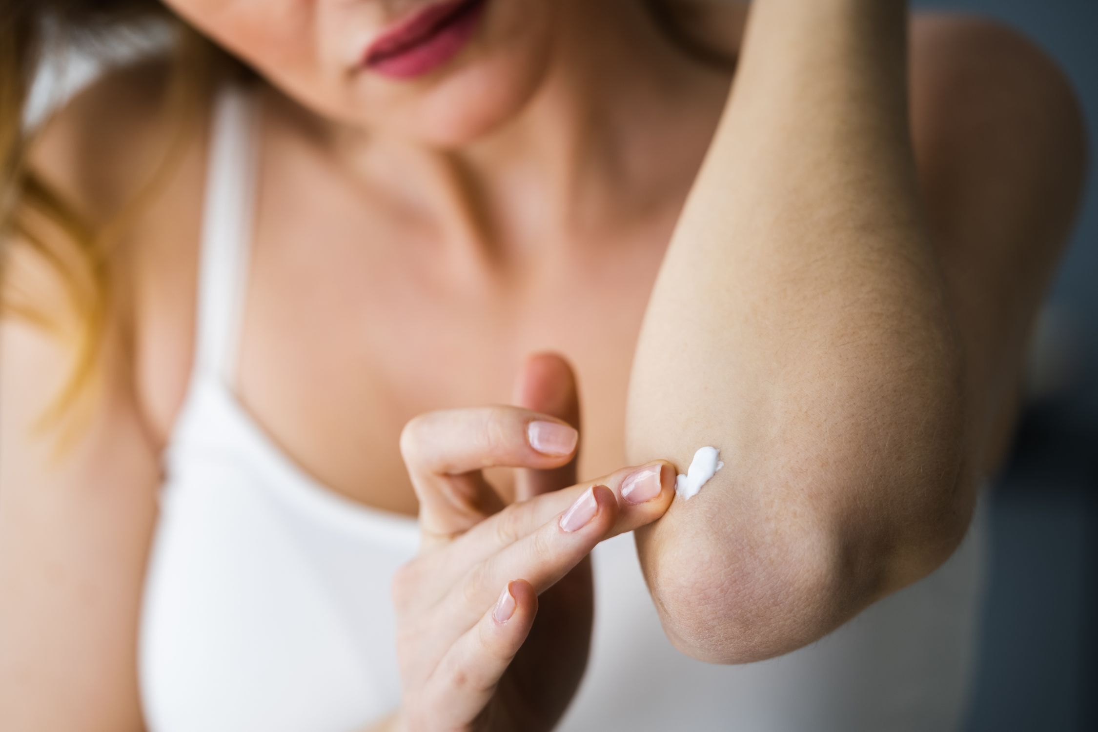 Frau cremt sich trockene Haut am Ellebogen ein